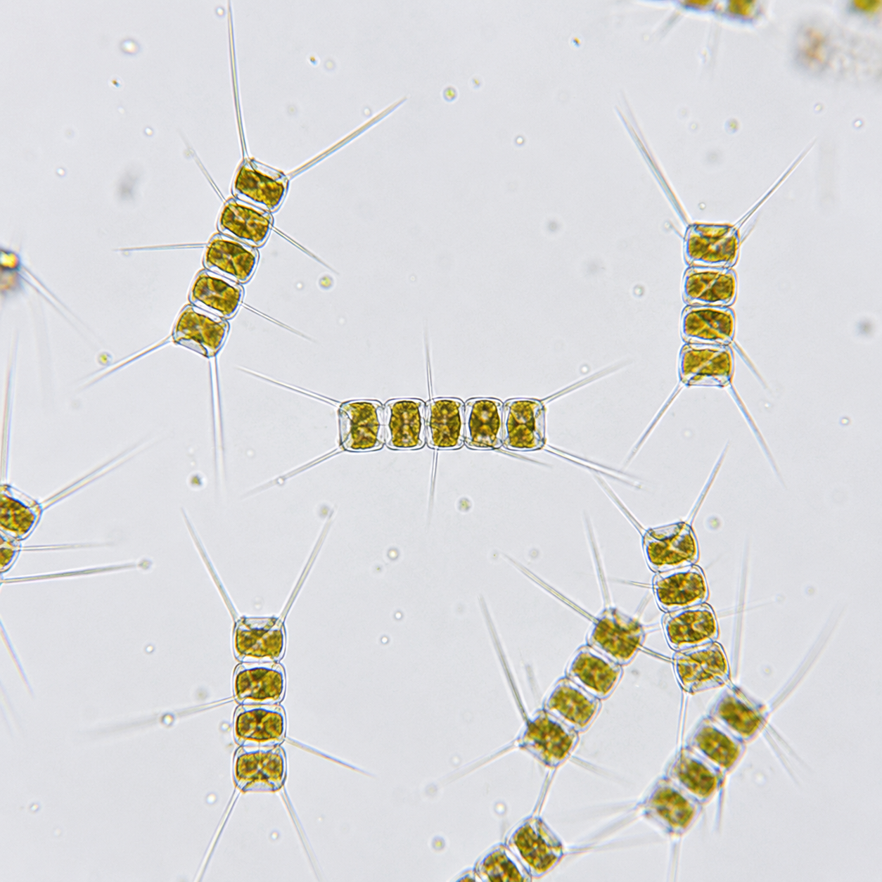 Chaetoceros au microscope